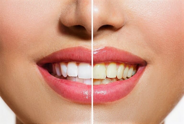 Light Dental Clinic, clinica stomatologica,